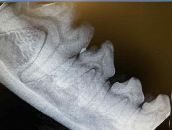 Digital Dental Radiology